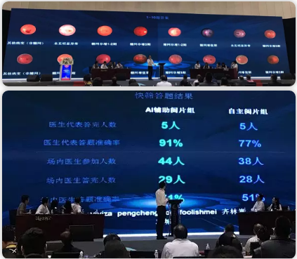 眼視光