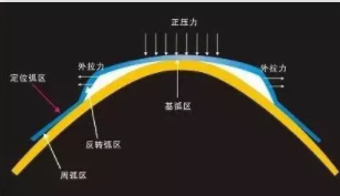 角膜塑形鏡