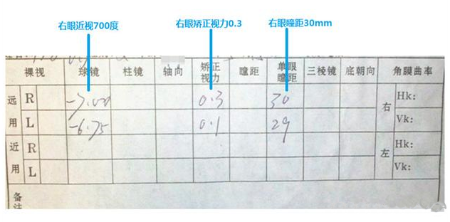 驗(yàn)光單怎么看