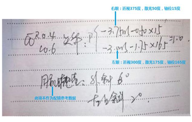 驗(yàn)光單怎么看