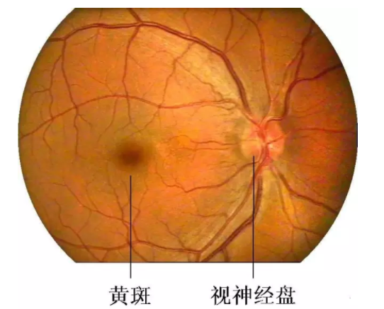 葉黃素是防止黃斑病變致老年失明的“視黃金”--驗光師培訓科普