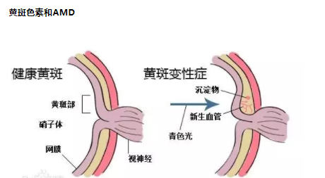 葉黃素是防止黃斑病變致老年失明的“視黃金”--驗光師培訓科普