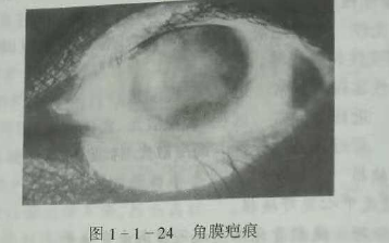 初級驗光師培訓(xùn)知識點：影響視覺的原因分析