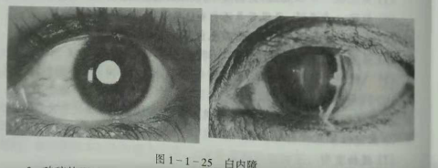 初級驗光師培訓(xùn)知識點：影響視覺的原因分析