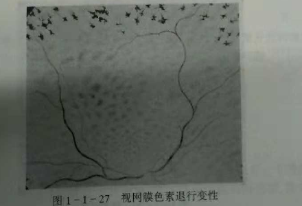 初級驗光師培訓(xùn)知識點：影響視覺的原因分析