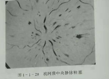 初級驗光師培訓(xùn)知識點：影響視覺的原因分析