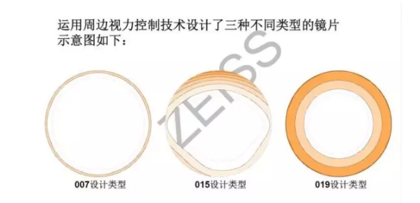 【驗光師分享】環(huán)焦、全焦和離焦這3種鏡片有什么區(qū)別？
