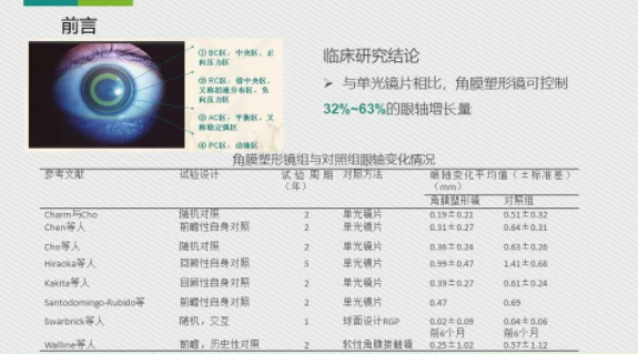 眼科醫(yī)院眼視光醫(yī)師分享角膜塑形鏡的復(fù)診流程