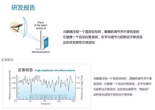 【驗(yàn)光師培訓(xùn)分享】鏡片挑選的真相在哪？