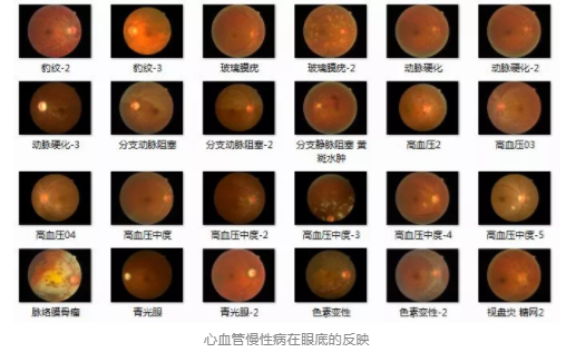 視光變革者寶島眼鏡CEO王智民：AI是慢性病、近視防控救星
