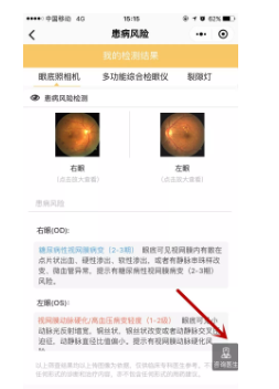 視光變革者寶島眼鏡CEO王智民：AI是慢性病、近視防控救星