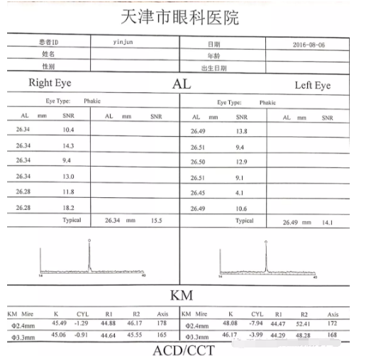 眼視光行業(yè)分享圓錐角膜驗配RGP經(jīng)驗