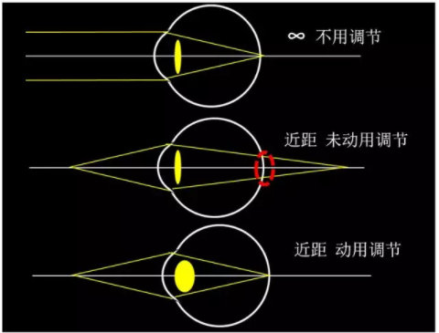 東莞驗(yàn)光師培訓(xùn)課程