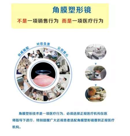 驗(yàn)光師帶您了解角膜塑形鏡的來龍去脈