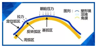 驗光師講述孩子戴了角膜塑形鏡近視度數(shù)還會漲嗎？