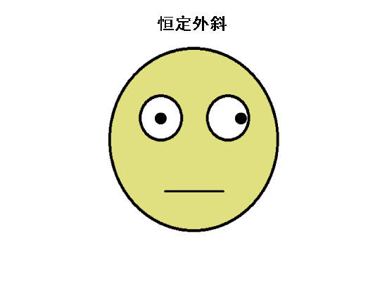驗光配鏡中遇到的20多種斜視眼位特點