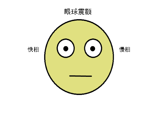 驗光配鏡中遇到的20多種斜視眼位特點