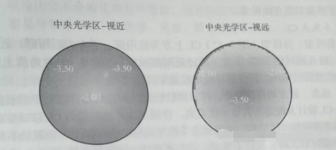 天津市眼科醫(yī)院視光中心張姝賢主任：多焦點軟性接觸鏡矯正老視的驗配要點