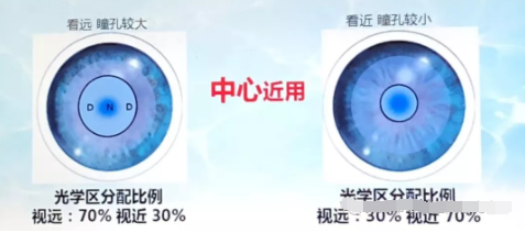 天津市眼科醫(yī)院視光中心張姝賢主任：多焦點軟性接觸鏡矯正老視的驗配要點