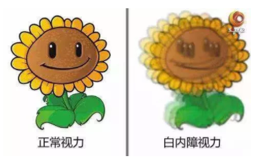 央視《健康之路》：你知道嗎？老花眼視力變好，有可能是患了白內(nèi)障