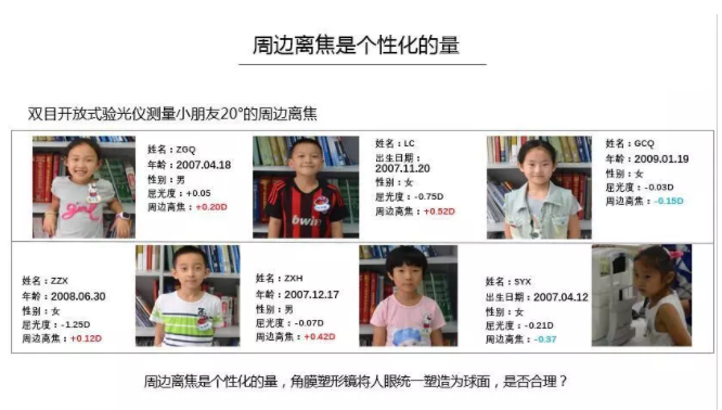 【眼視光前沿】一種具有非球面基弧設(shè)計(jì)的角膜塑形鏡