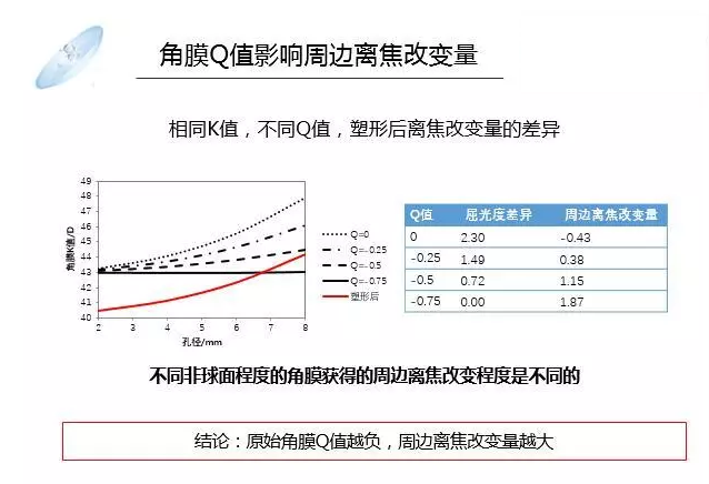 【眼視光前沿】一種具有非球面基弧設(shè)計(jì)的角膜塑形鏡